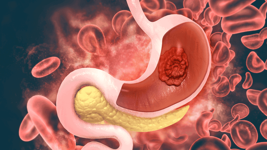 Health Guide - The Stomach from Crystal Health & Beauty