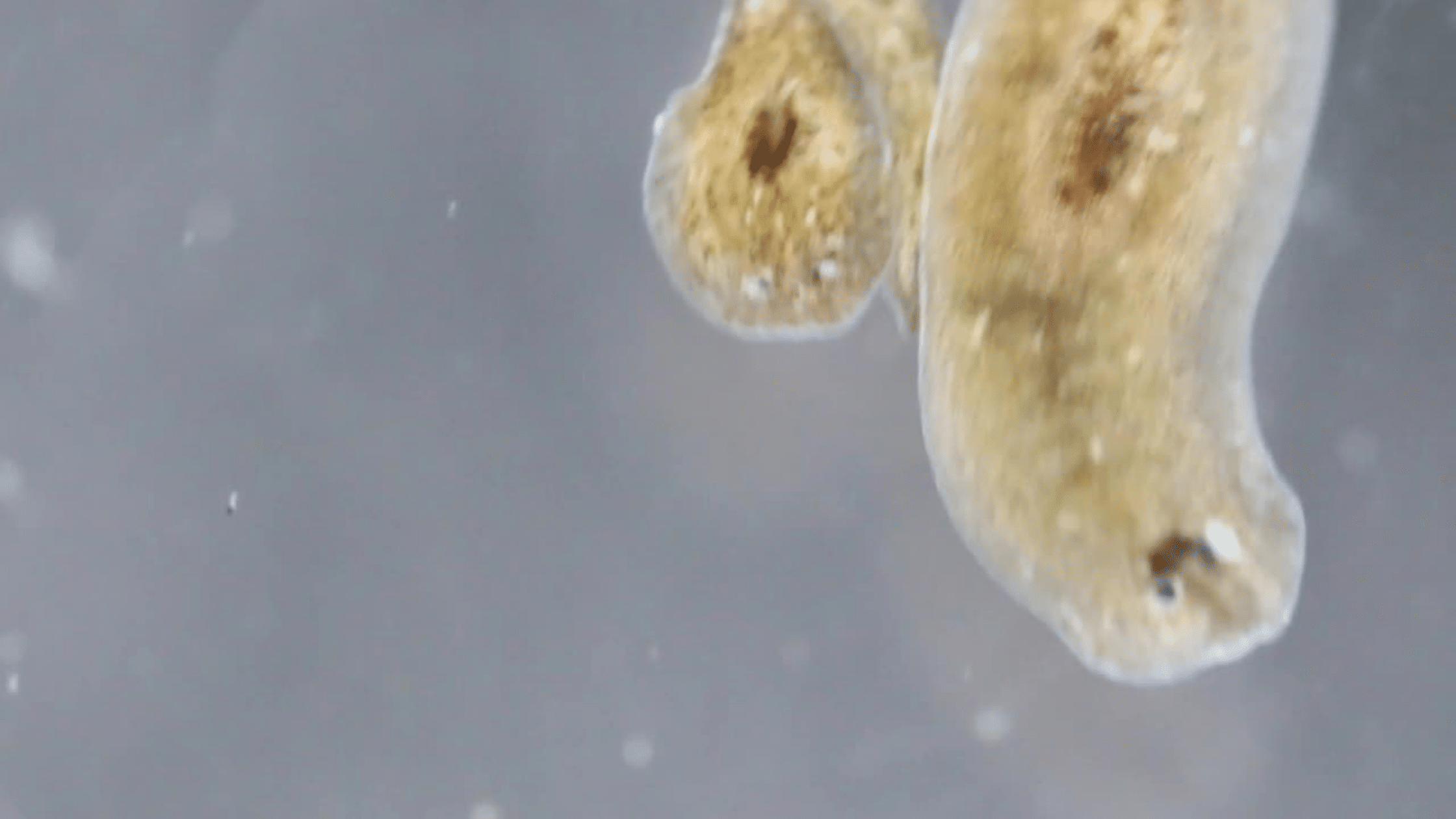 Parasites That Can Lead to Complications